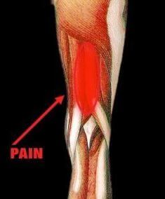 Hamstring Pain