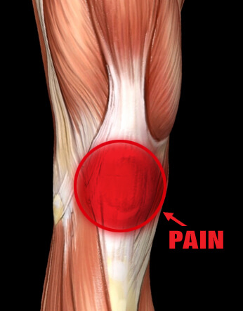 Knee Osteoarthritis