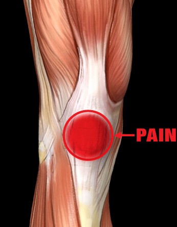 Patello-Femoral injury